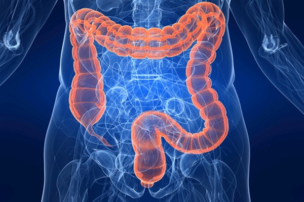 Il Morbo di Crohn, cosa è quali sono le cause