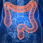 Il Morbo di Crohn, cosa è quali sono le cause