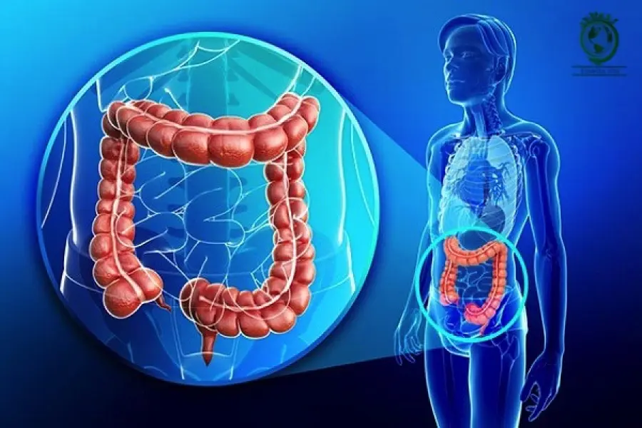 Tumore al colon, ecco perché è pericoloso l’utilizzo di troppi antibiotici