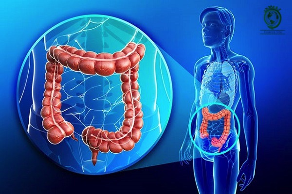 Tumore al colon, ecco perché è pericoloso l’utilizzo di troppi antibiotici