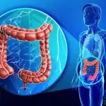 Tumore al colon, ecco perché è pericoloso l’utilizzo di troppi antibiotici